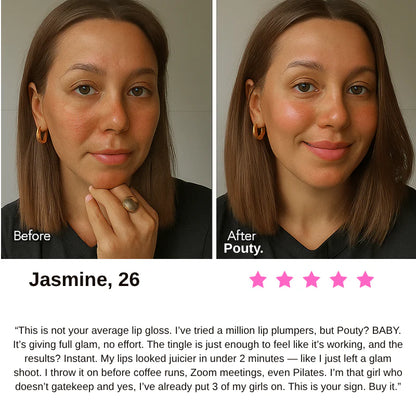 NuvoroGloss Balm™